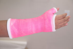 Hand Wrist Cast thumb Spica multicolor cast