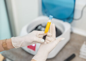 Close up od doctor's hands with surgical gloves while preparing blood collection tubes for centrifuge machine
